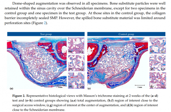 cd468ec882a4f20682bb72a21e269420_1684340891_4427.png